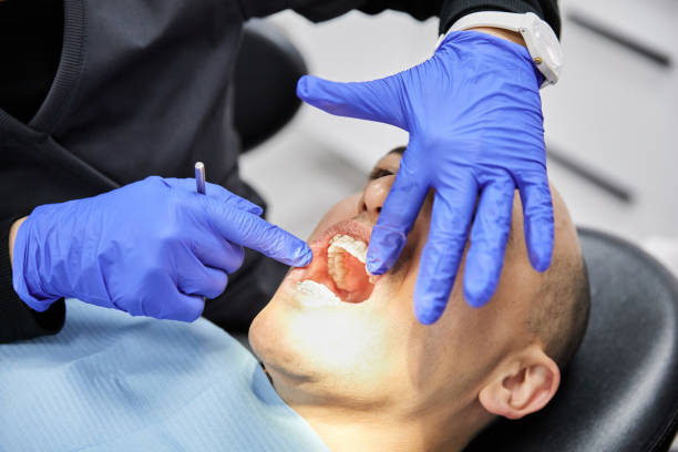 Best Broken or Chipped Tooth Repair in Hilltop, SC
